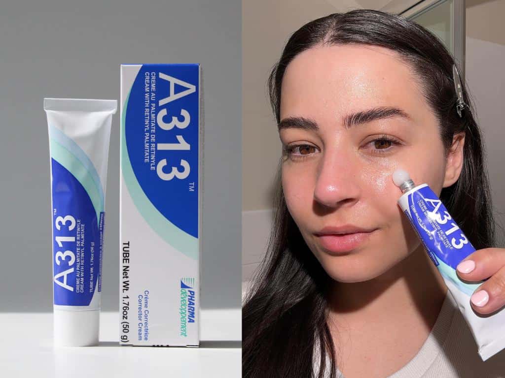 4 Weeks Using A313 on Acne-Prone Skin - A Real Review