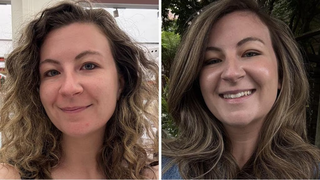 4 Weeks Using A313 - An Australian Beauty Editor’s Honest Review